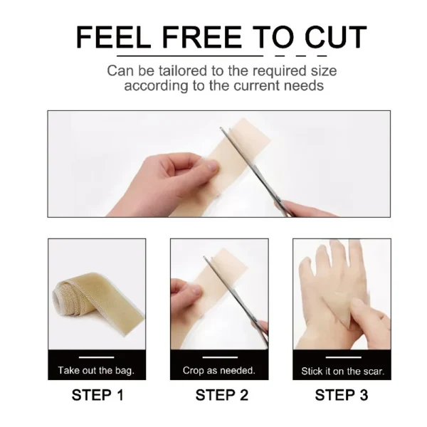 1 Roll = 4CM x 3M Silicone Scar Sheets Self-Adhesive Stretch Mark Tape Scar Cover Patch Reusable and Effective Skin Care Strips - Image 2