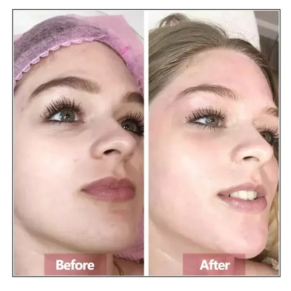 Hyaluronic Acid Face Serum Essence Skin Repair Rejuvenation Firming Moisturizing Hydrating Anti Aging - Image 3